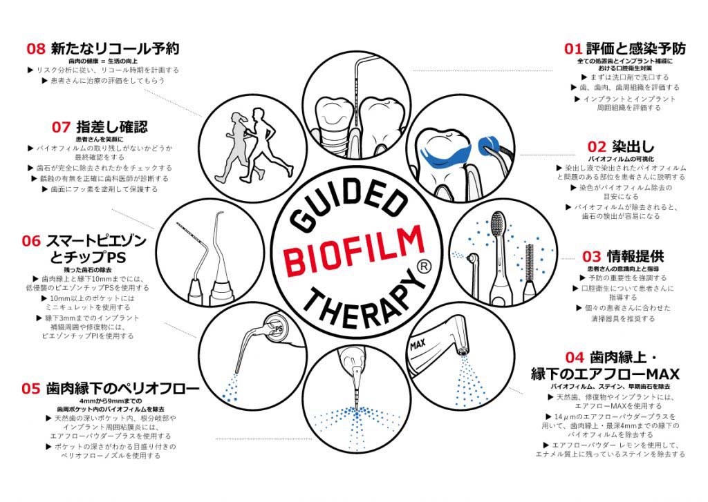 GBTによる治療の流れ